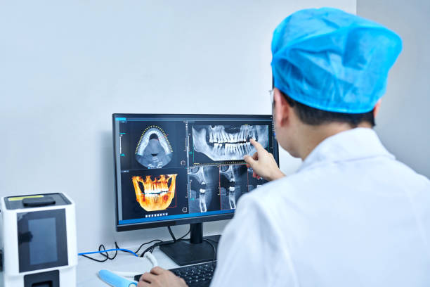 Best Knocked-Out Tooth (Avulsed Tooth) Treatment in Jennings Lodge, OR